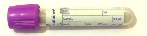 virology blood test bottle|blood bottle toxicology test.